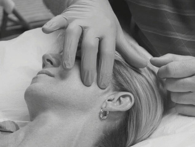 Dry needling behandeling rond de kaakregio